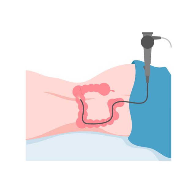 Endoscopy Colonscopy