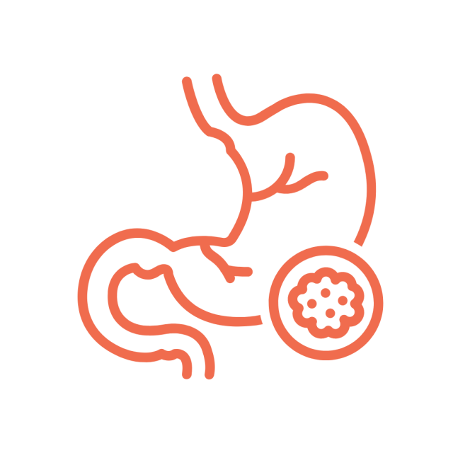 GIST s Gastrointestinal Stromal Tumours