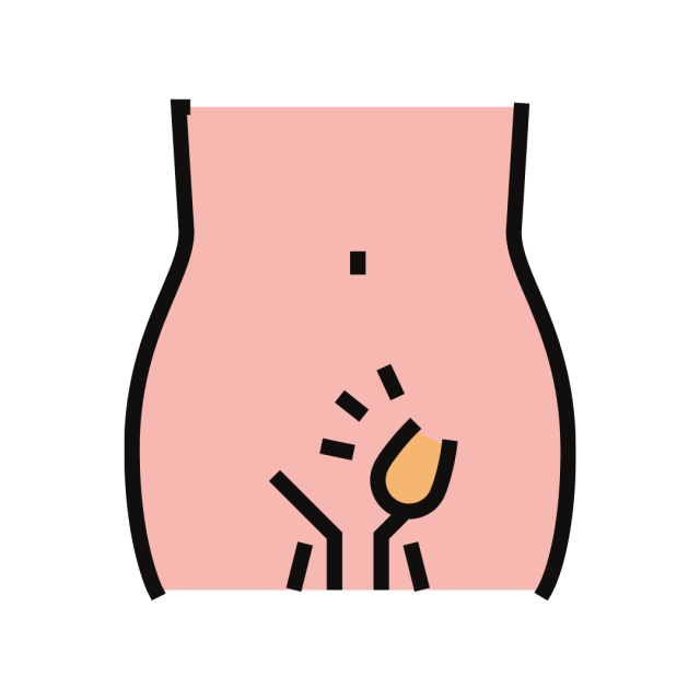 Inguinal Hernia