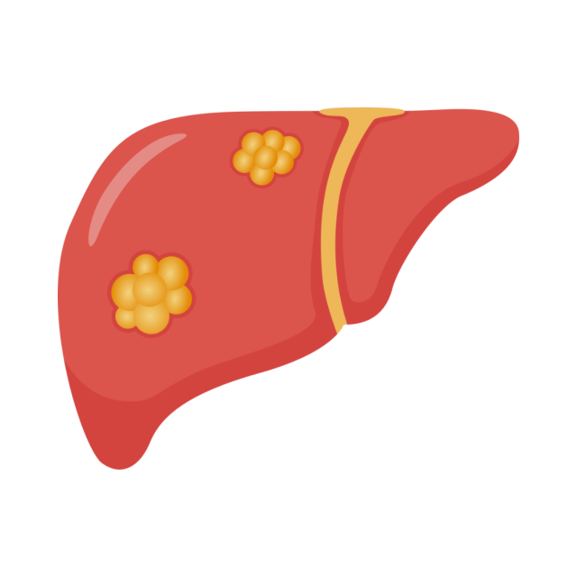 Liver disorder