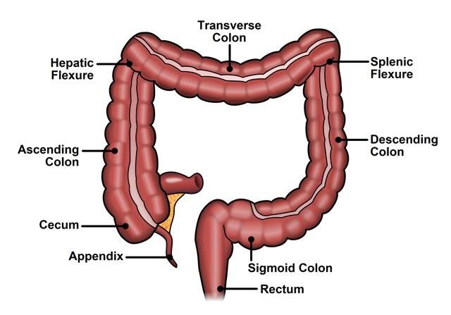 Rectal Cancer