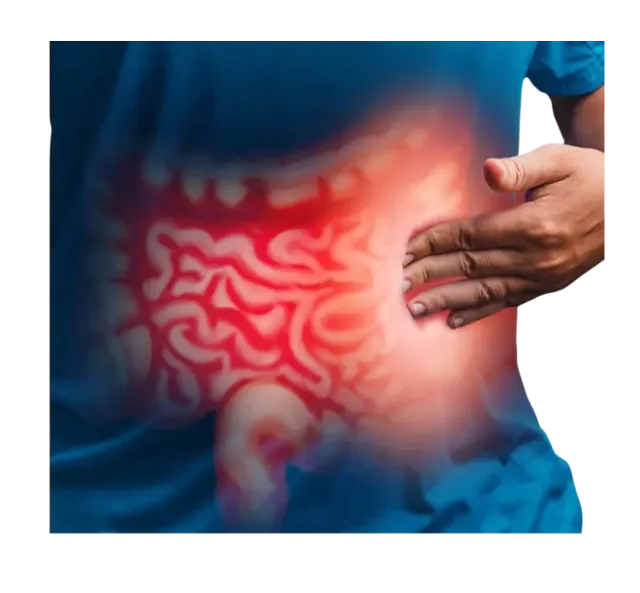 Small bowel cancer 2