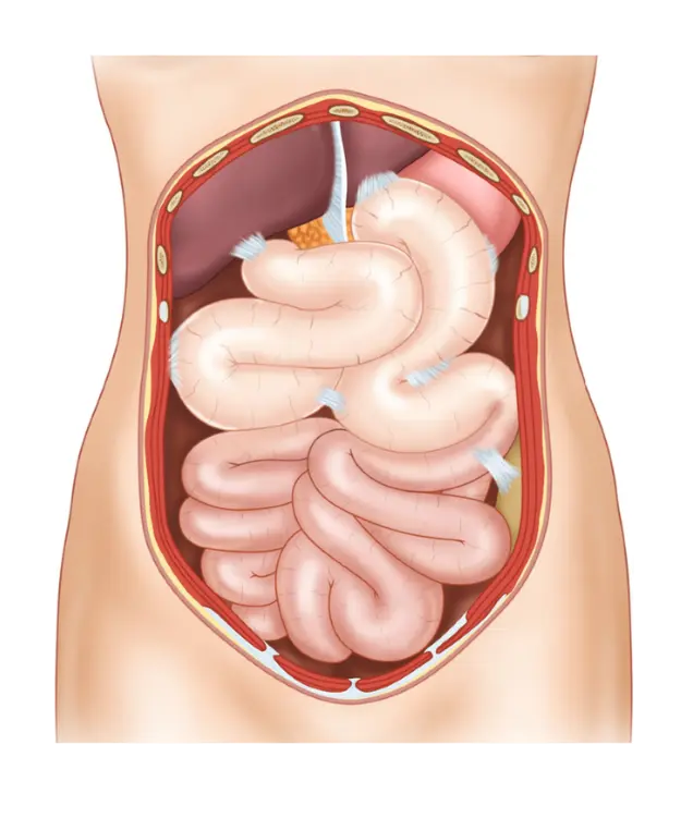 Small Bowel Disorders Small Intestine Disorders Intra Abdominal Adhesions 1