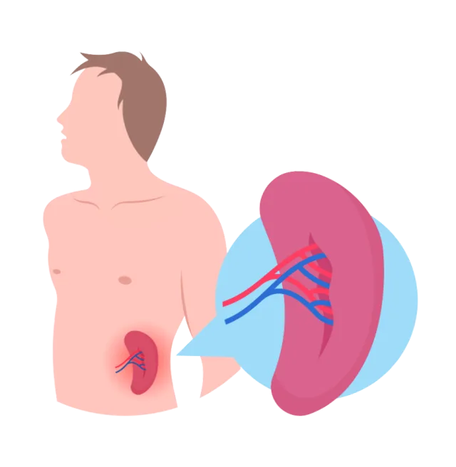 Spleen 1